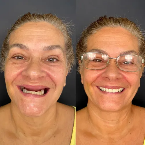 Beige-Minimalist-Skincare-Before-and-After-Instagram-Post.webp
