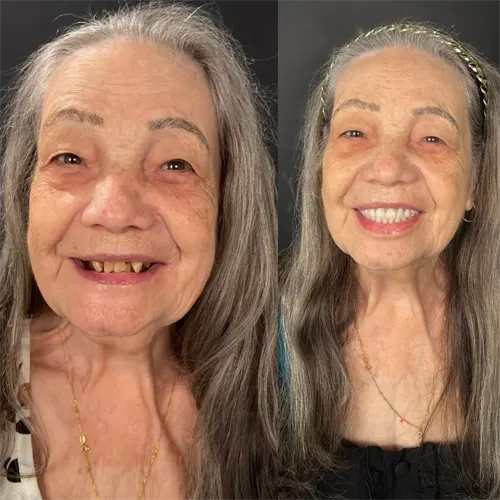 Beige Minimalist Skincare Before and After Instagram Post1