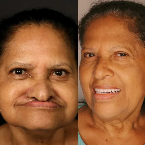 Beige Minimalist Skincare Before and After Instagram Post2
