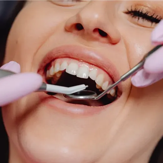 Implantes 
