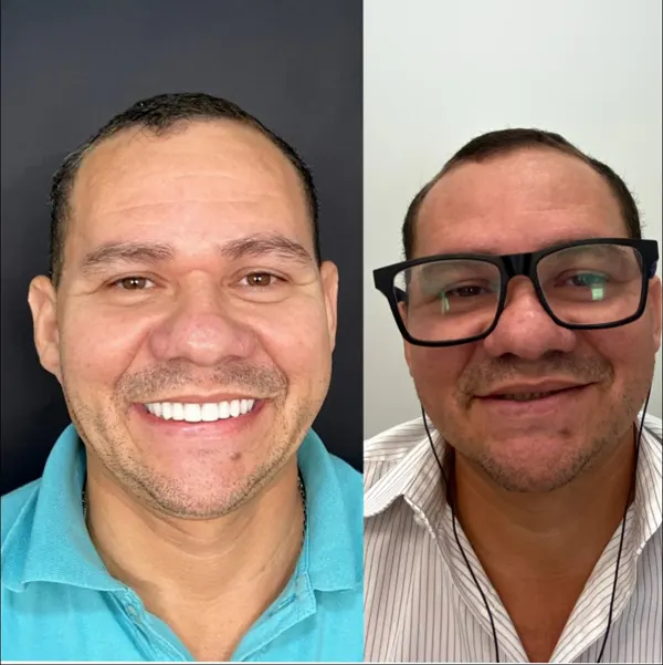 homem 40 anos antes e depois 1 1