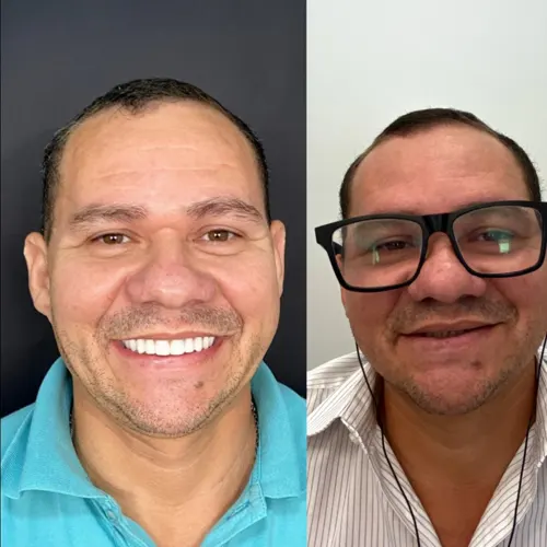homem 40 anos antes e depois 1 2