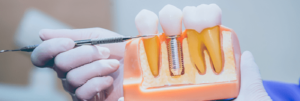 manequim odontologico blog eu amo odonto dental speed