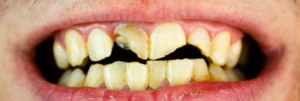 ds 2904 restauracao dentaria banner home